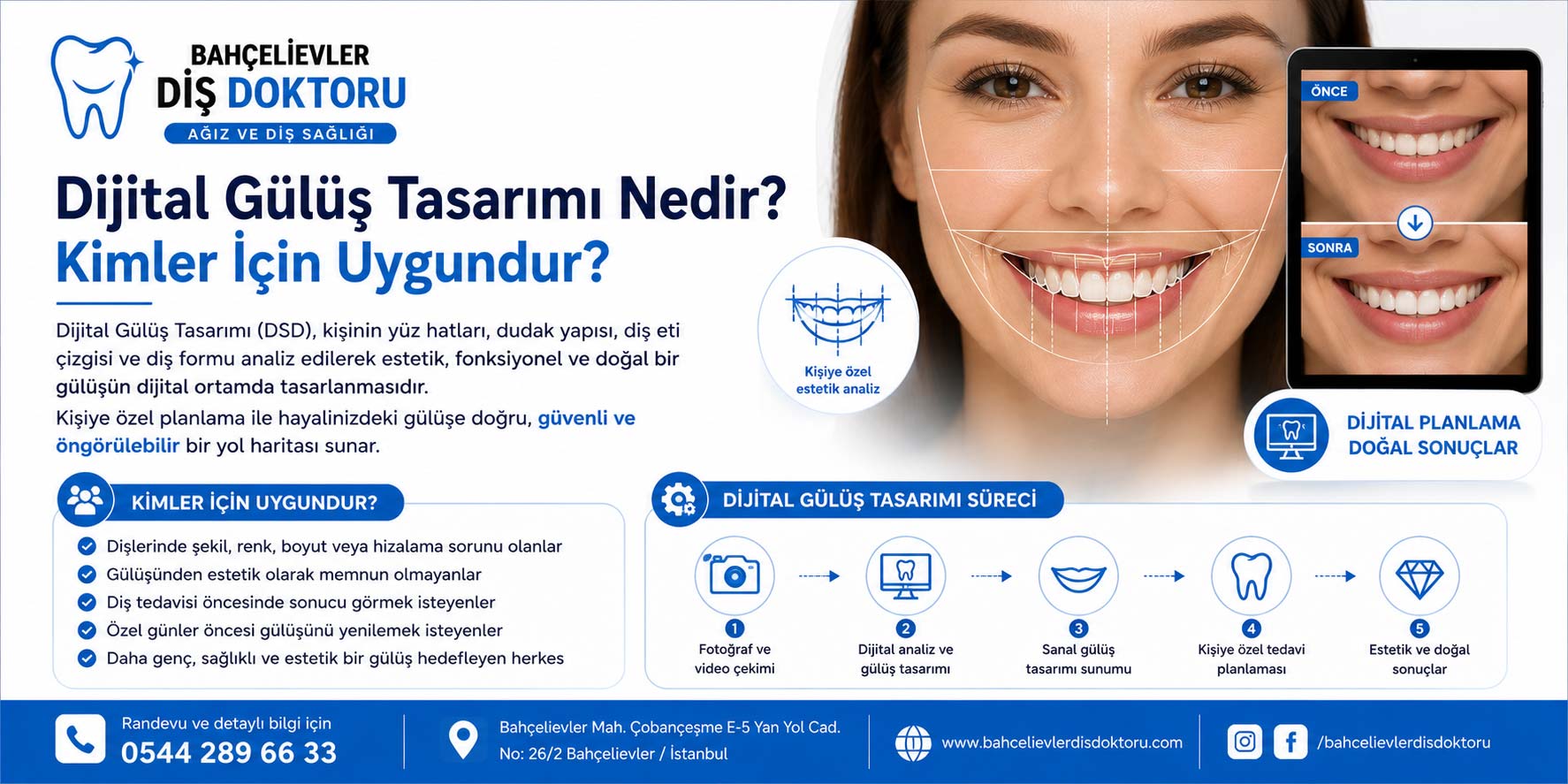 Dijital Gülüş Tasarımı Nedir? ...