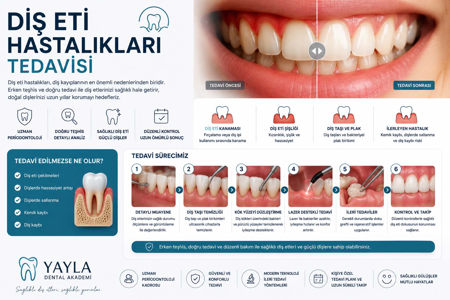 Diş Eti Hastalıkları Tedavisi