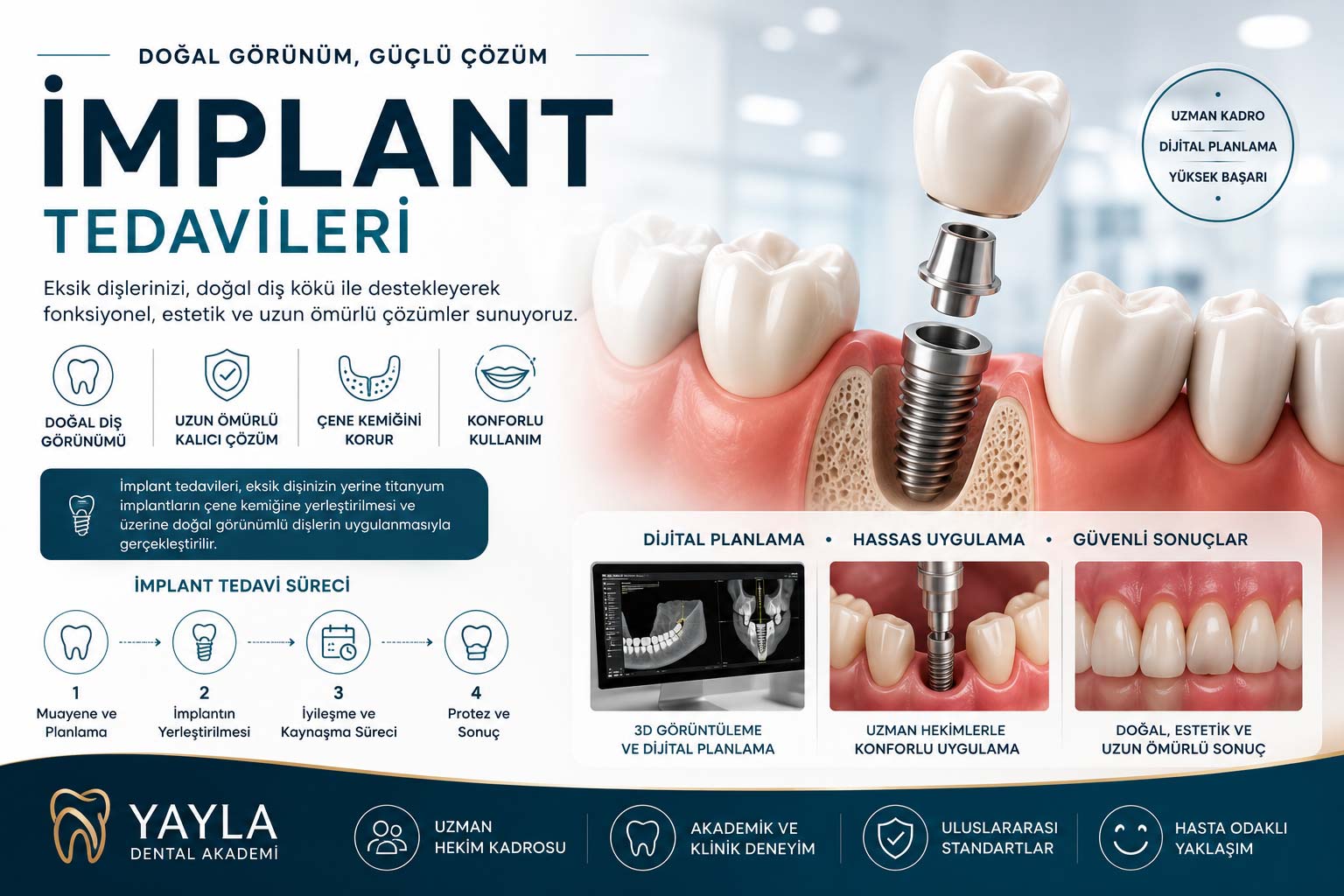 İmplant Tedavileri