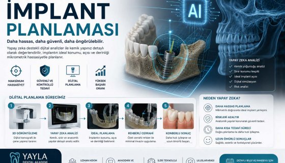 Yapay Zeka ile İmplant Planlaması